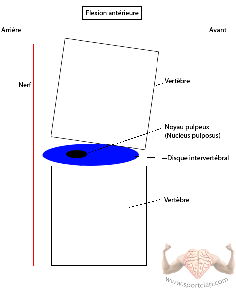 La colonne vertébrale : réaction du disque intervertébral et position des vertèbres lors d'une flexion du dos rachis (se pencher vers l'avant)